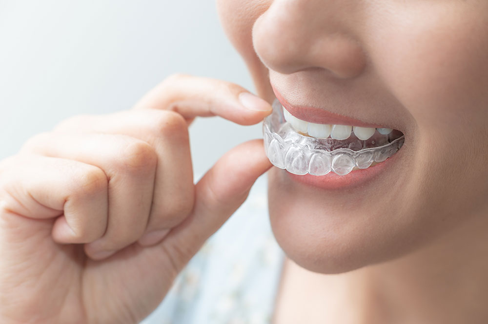 Invisalign in Austin, TX