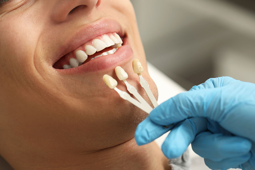 Teeth Whitening in Austin, TX